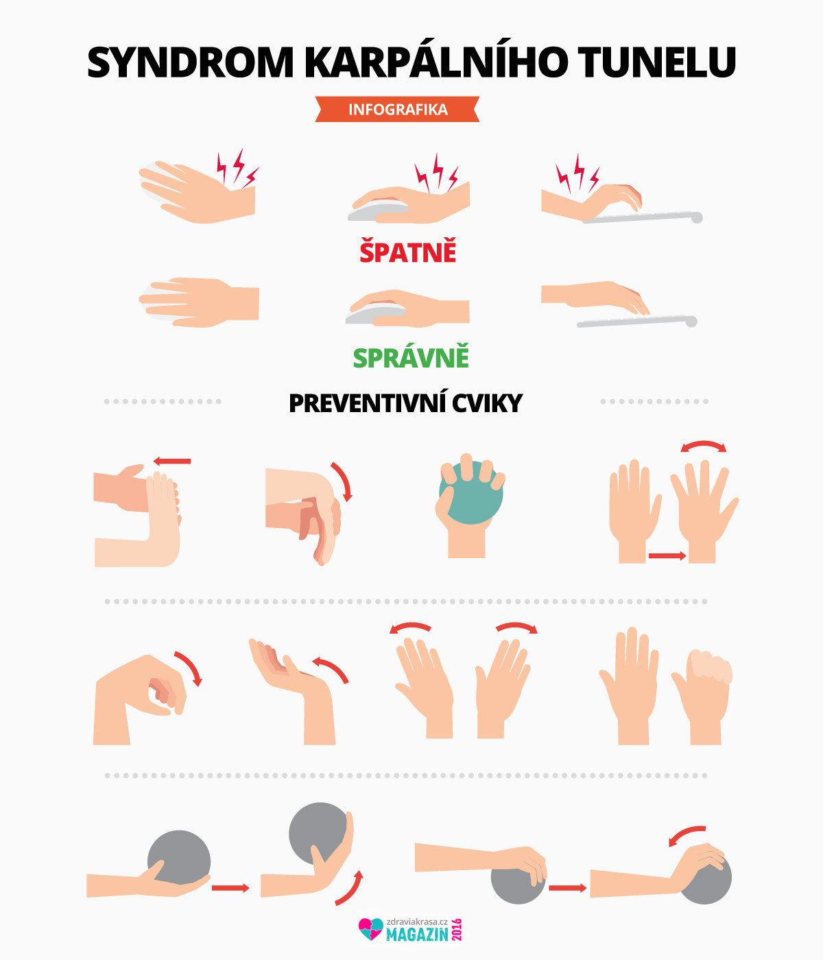 Infografika, zdroj: https://www.zdraviakrasa.cz/wp-content/uploads/2016/10/25/03-syndrom-karpalniho-tunelu.jpg
